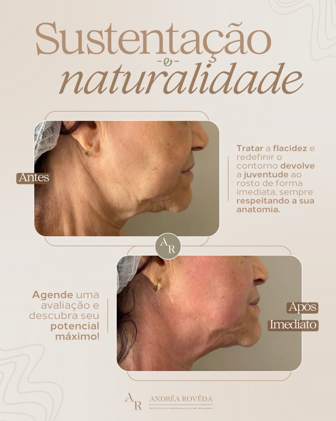 Resultado de Hi Pro com foco em sustentação e naturalidade