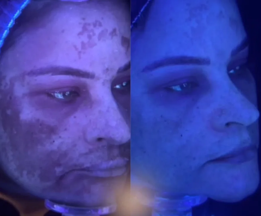 Antes e depois de avaliação de manchas sob luz azul