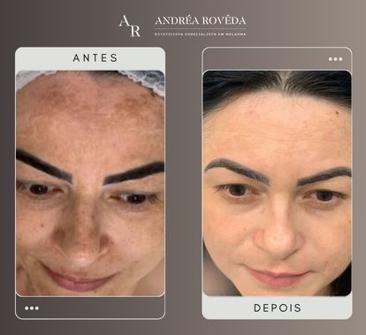 Tratamento de pele Várzea Paulista