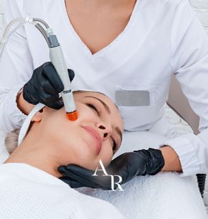 Tratamento de acne em Várzea Paulista